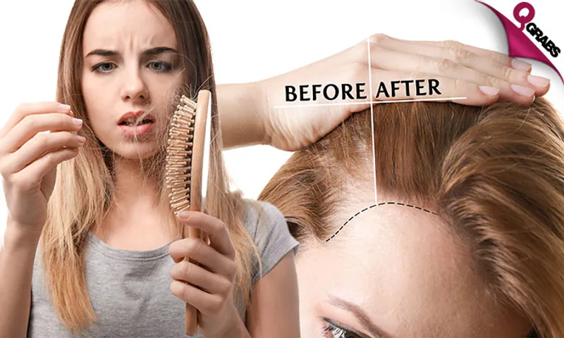 Anti-Hair Loss Treatment at DOT Beauty Salon!
